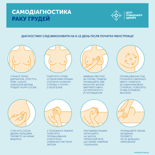 Самодиагностика рака груди